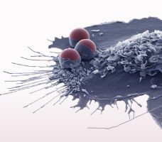 SoMM2026 : 9th SYMPOSIUM OF THE FRENCH NETWORK ON MONOCYTE-MACROPHAGE