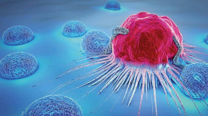 Augmentation des cas de cancer